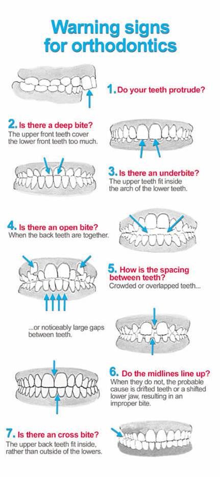 Orthodontist Richmond